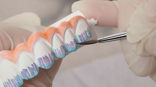 Case of the week Highlighting the CADCAM Denture Process [upl. by Odraude]