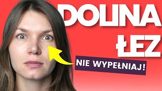 Pułapki DOLINY ŁEZ o Których Nie Wiesz – Kiedy NIE Wypełniać Doliny Łez Kwasem Hialuronowym [upl. by Johm427]