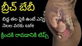 Baby Breech Position During Pregnancy InTelugu బేబీ బీచ్ పొజిషన్ Anithachandra Creations [upl. by Tove554]