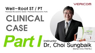 ENG Well Root STPT Clinical Case Part 1 [upl. by Aieki128]