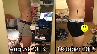 How to Fix APT Anterior Pelvic Tilt  EatLiftGain [upl. by Enilarac]