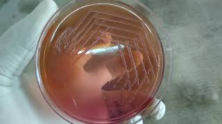 Morgenella morganii Colony Morphology on Macconkey Agar Demonstration [upl. by Donnenfeld]