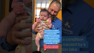 Torticollis in infants can be treated by pediactric Chiropractors torticollis baby infant [upl. by Trelu]