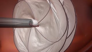 GORE® CARDIOFORM Septal Occluder PFO Animation [upl. by Larine]