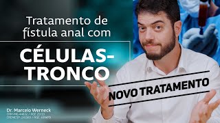 Tratamento de Fístula Anal com CélulasTronco [upl. by Otilegna]