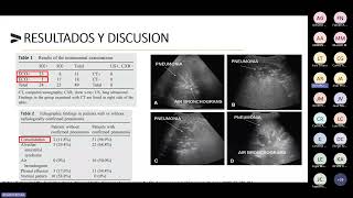 Evaluación de Consolidación Pulmonar por Ecografía [upl. by Alissa]