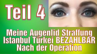 Schlupflider Operation Vorher Nachher Augenlidstraffung Erfahrung Türkei Oberlidstraffung [upl. by Ally410]