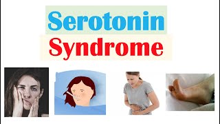 Serotonin Syndrome  Causes Medications Pathophysiology Signs amp Symptoms Diagnosis Treatment [upl. by Aneeuq]