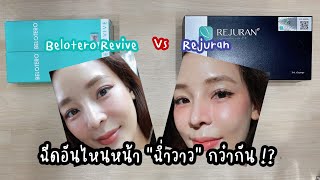 Belotero Revive กับ Rejuran ฉีดอันไหนหน้าฉ่ำวาวกว่ากัน [upl. by Ihcelek]