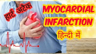 Myocardial infarction in hindi Part 2 [upl. by Aleacim]