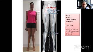 Across Atlantic Webinar Series Osteotomies around the Knee How I do it [upl. by Knowlton]