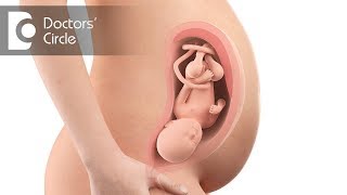 What is Low Lying Placenta amp its causes  Dr Lalitha Sudha Alaparthi [upl. by Adiana]