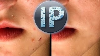 Adobe Photoshop Elements 10 Removing Pimples Photoshop Elements Tutorial [upl. by Yatnuhs]