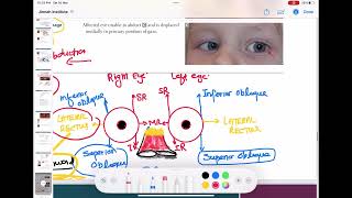 trochlear and abducens nerve palsy ophthalmology 30  First Aid USMLE Step 1 in UrduHindi [upl. by Nisaj923]