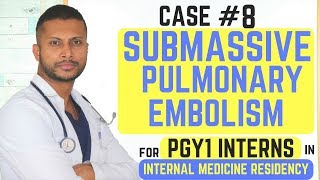 Submassive Pulmonary Embolism  Internal Medicine Residency Series [upl. by Urissa]