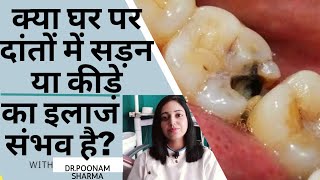 दांतों की सड़न का इलाज क्या घर पर कर सकते हैंdental cavity treatmentDanton mein Sadan ka ilaaj [upl. by Nennahs]