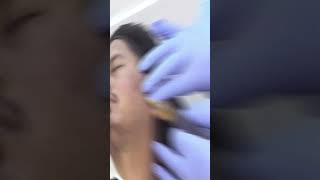 Thread Lifting Procedure ✅  Facematic Trainings India  facialaesthetics shortsvideo [upl. by Aciretahs]