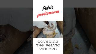 Peritoneum covering the pelvic viscera pelvic cellular tissue shorts peritoneal pelvis [upl. by Riobard]