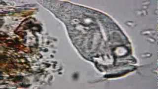 Rotifer at x600 under Celestron PentaView Digital [upl. by Sheedy]