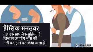 Choking I Heimlich Maneuver I Live saving Technique in Hindi [upl. by Tabbi]