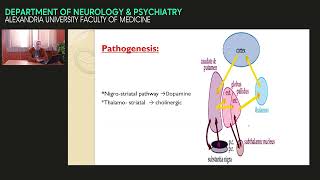 Parkinsonism and movement disorders  Prof Dr Horeya Sadallah [upl. by Dub490]