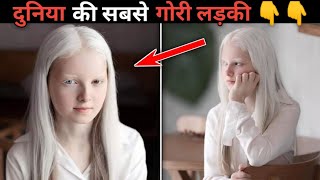 दुनिया की सबसे गोरी लड़की 😱😱  Amina Ependieva  shorts  AZ Facts [upl. by Aipotu985]