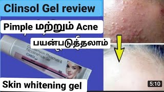 clinsol Gel review in Tamil Best cream for pimples and acne best skin whitening cream [upl. by Davis287]