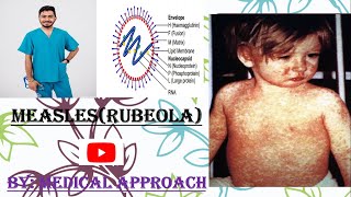 Measles Rubeola Virus  Virology [upl. by Gannon]