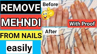 Henna Removal Part 1  Vitamin C and Oil Method [upl. by Nytram]