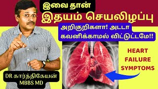 இதுதான் இதயசெயலிழப்பா  Heart Failure Symptoms health awareness  dr karthikeyan [upl. by Rochella]