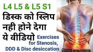 exercises for back pain Disc Dessication stenosis l4l5 l5s1 facet joint by dr sandeep Bhardwaj [upl. by Lizette905]