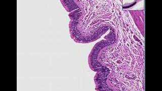 Histopathology Lung bronchus Cryptosporidium [upl. by Clercq273]