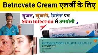 All About Betnovate Cream betnovate c skin creamBetamethasone Valerate Cream IP Usesside Effects [upl. by Ahsiuqram]