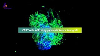 Revolutionizing the monitoring of CAR T cell therapies against solid tumors with the 3D imaging [upl. by Lleihsad760]