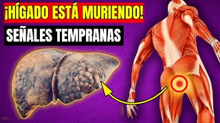 🚨 ¡8 Signos de que Tu Hígado ESTÁ MURIENDO ¡NO LAS IGNORES 🚨 [upl. by Losiram]