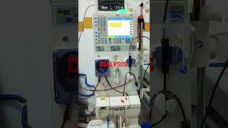 Dialysis with Fresenius 4008s OCM machine shortsfeed dialysis viralshort ytshorts [upl. by Rebel]