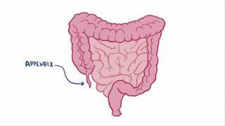 Vermiform appendix by Dr Dileep shah [upl. by Seiden381]