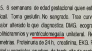 VENTRICULOMEGALIA Un Milagro Llamado Jeronimo [upl. by Inge]