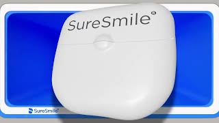 SureSmile Clear aligners [upl. by Rai]