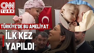 Türk Doktorlar Kafadan Yapışık İkizleri Ayırdı 25 Milyonda Bir Görülen Vaka [upl. by Cherie]