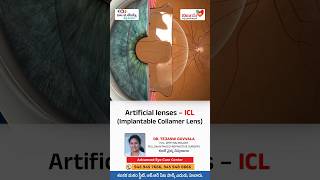 Artificial lenses  ICL Implantable Collamer Lens  Dr Tejaswi Guvvala  Vijaya Hospital  Eluru [upl. by Bois]