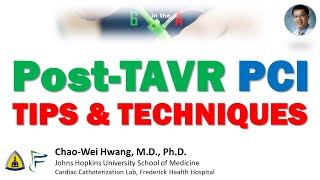 PostTAVR PCI Tips and Techniques [upl. by Nibla]