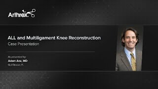 ALL and Multiligament Knee Reconstruction [upl. by Wandie]