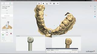 Adaptive Scanning in 3Shape amp Implant Scanning Workflow [upl. by Aggappera800]