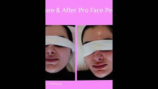 DERMALOGICA FACE PEEL [upl. by Yannodrahc]