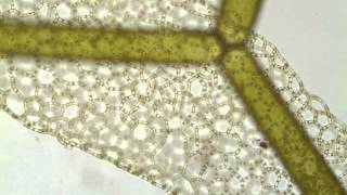 Hydrodictyon a netlike green alga [upl. by Kravits]