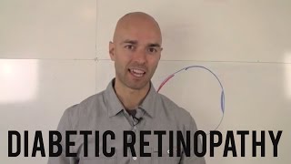 Diabetic Retinopathy What You Need to Know [upl. by Niahs]