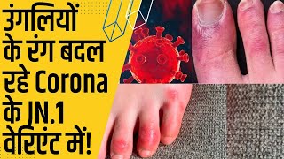 CORONA का नया वेरिएंट JN1 है 4th लहर का आगाज़  ALERT पर दुनिया [upl. by Adnovahs]