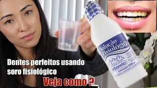 Dentes Perfeitos Usando o Soro Fisiológico Veja Como [upl. by Zaller]