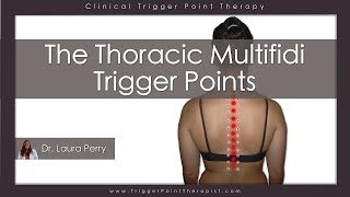 The Thoracic Multifidi Trigger Points [upl. by Niple]